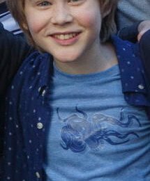 Casey Simpson